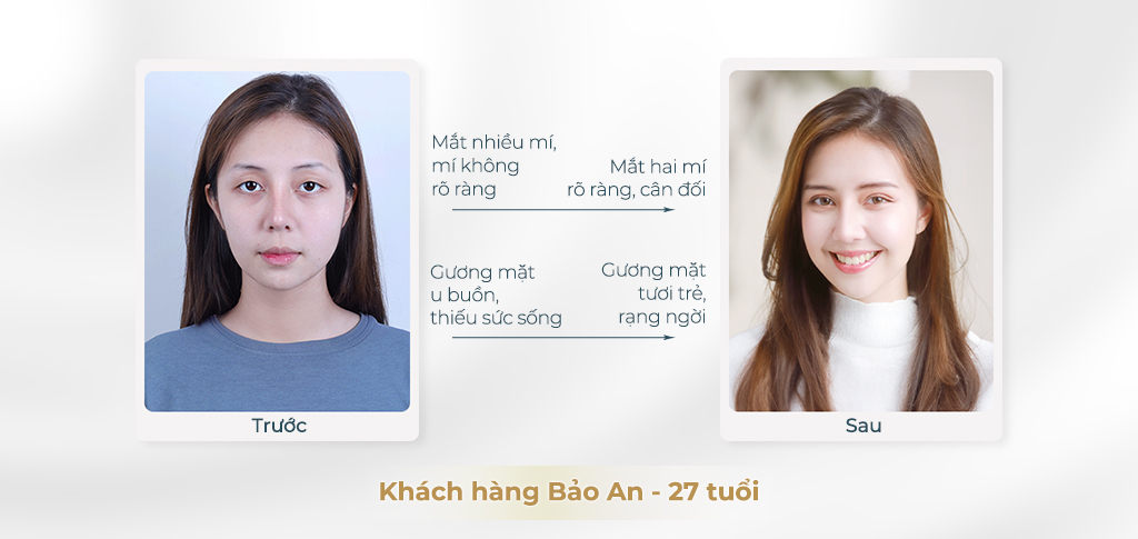 Trước và sau khi phẫu thuật mắt