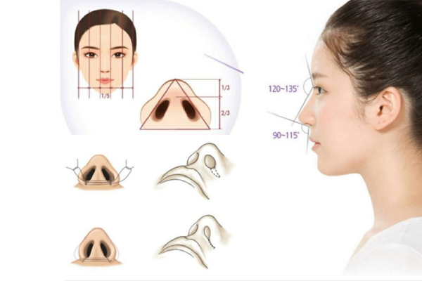 Thu gọn cánh mũi