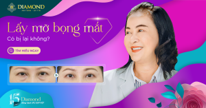 Lấy mỡ bọng mắt có bị lại không