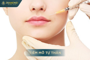 Tiêm mỡ tự thân vào môi