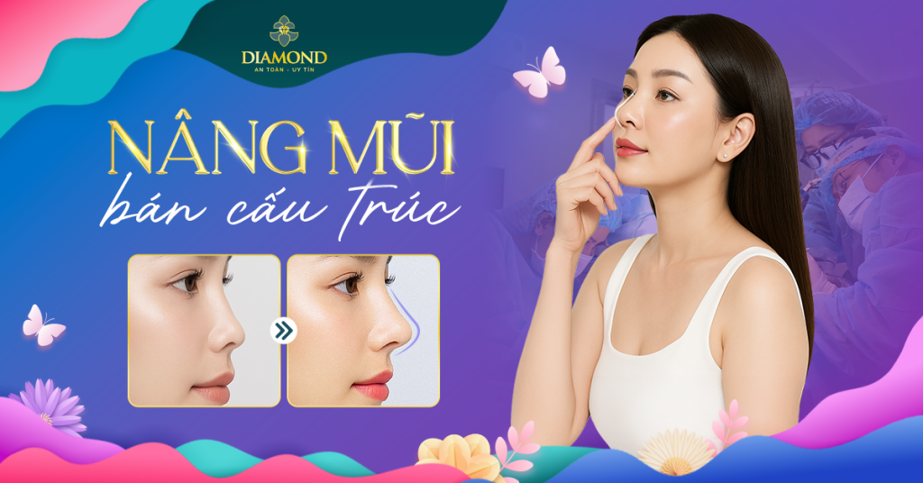 Nâng mũi bán cấu trúc