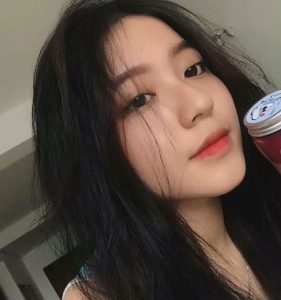 Nâng mũi cấu trúc sụn surgiform