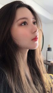 Nâng mũi cấu trúc surgiform